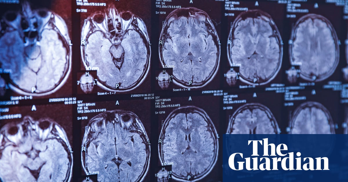 Alzheimer's drug rejected for widespread NHS use in England | Alzheimer's